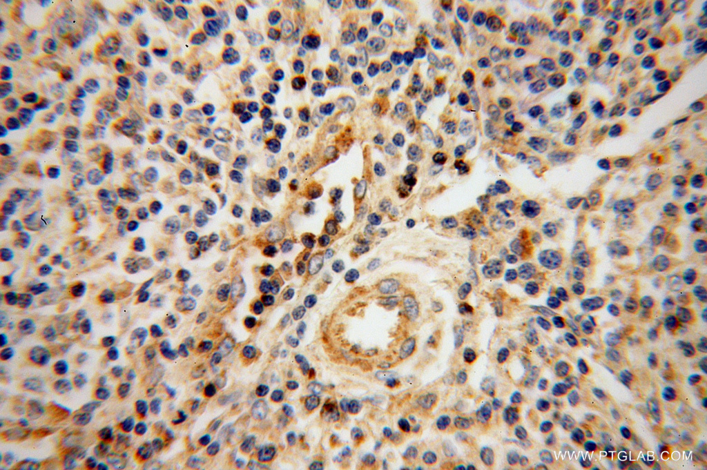 Granzyme A Polyclonal antibody