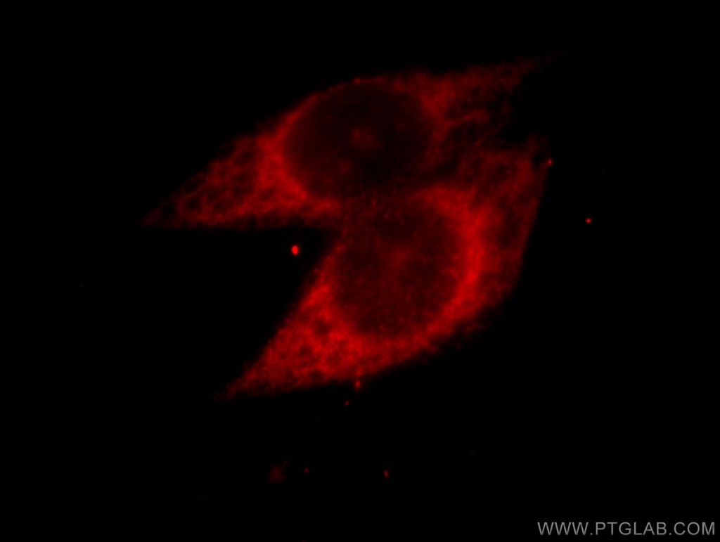 PARP3 Polyclonal antibody