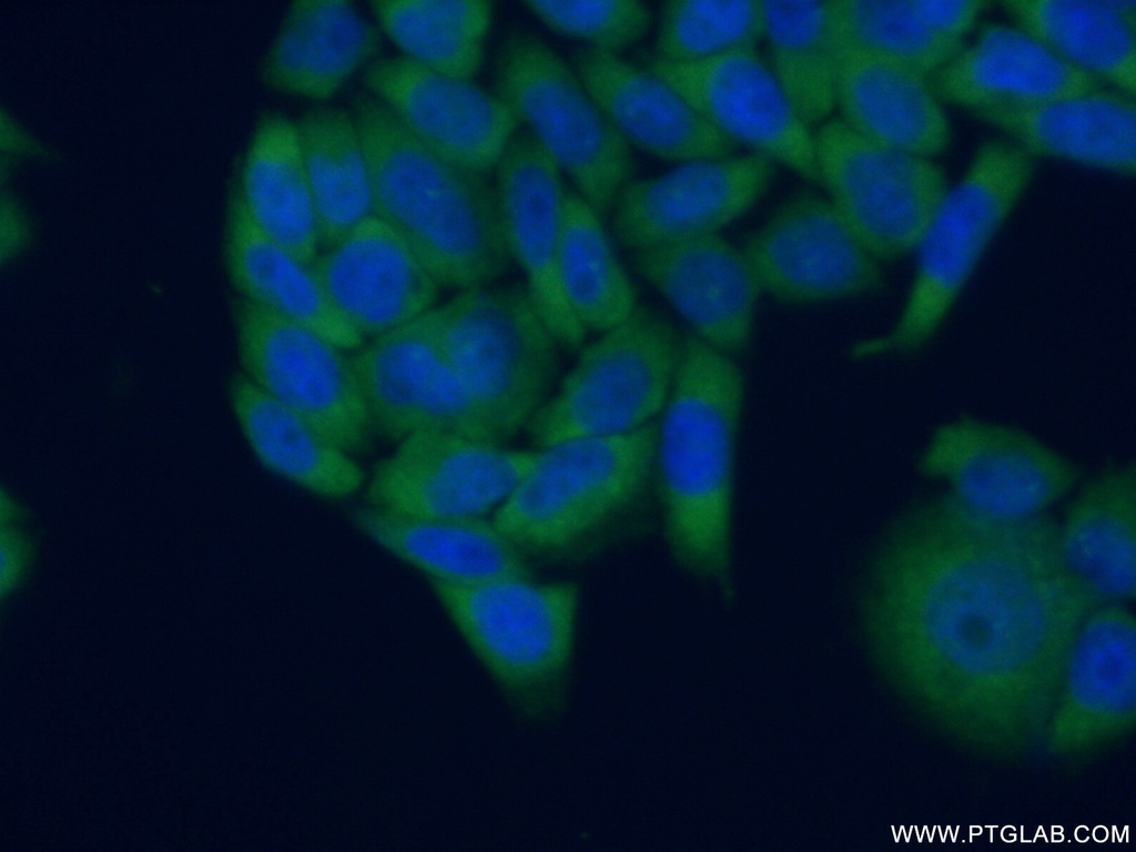 RPLP0 Polyclonal antibody