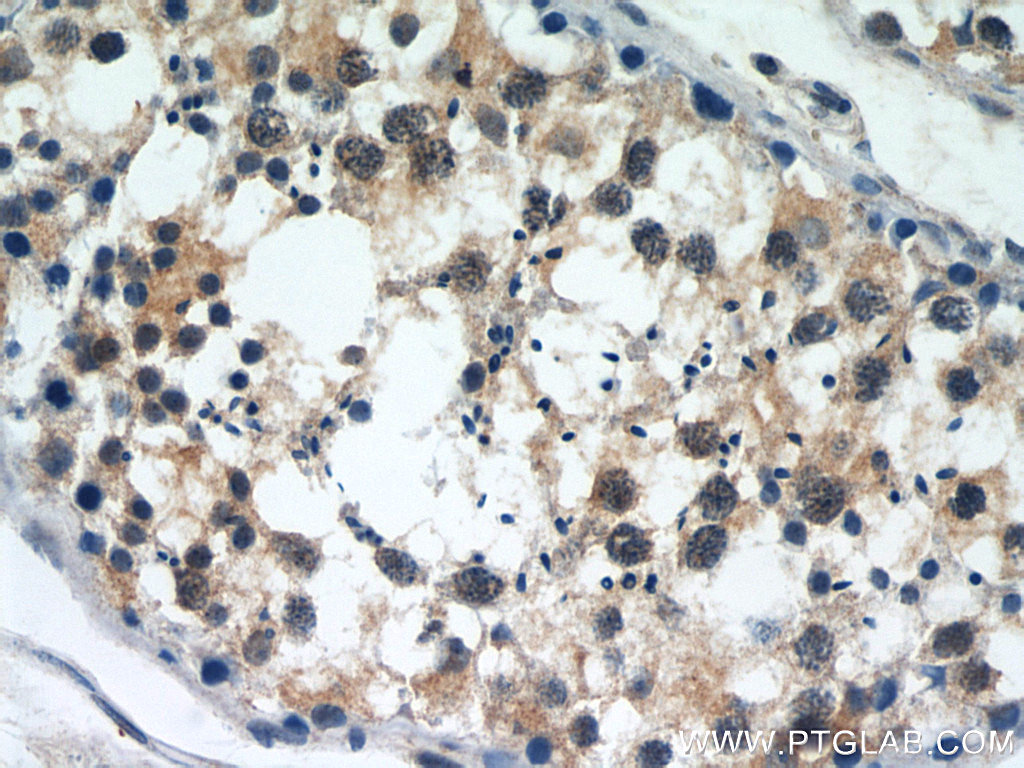 SERPINE2 Polyclonal antibody