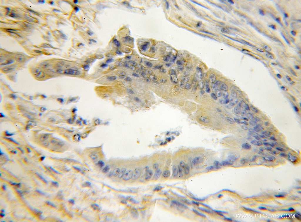 STMN3 Polyclonal antibody