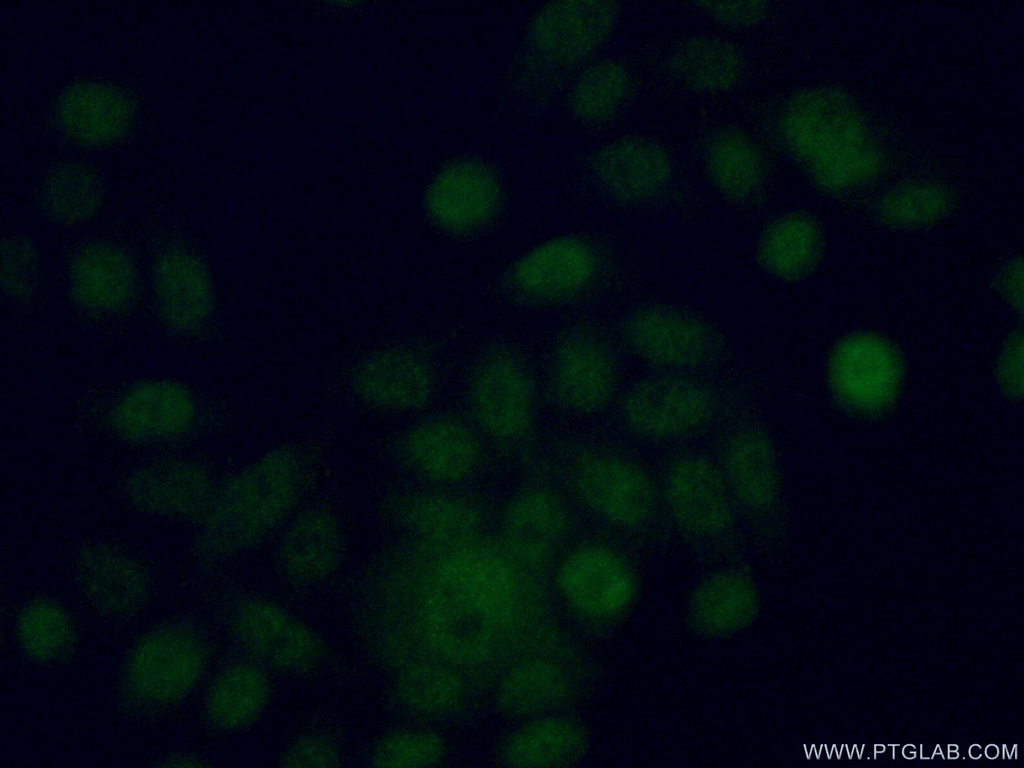 EYA2 Polyclonal antibody
