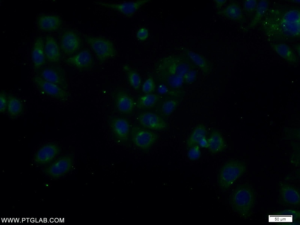 TOLLIP Polyclonal antibody