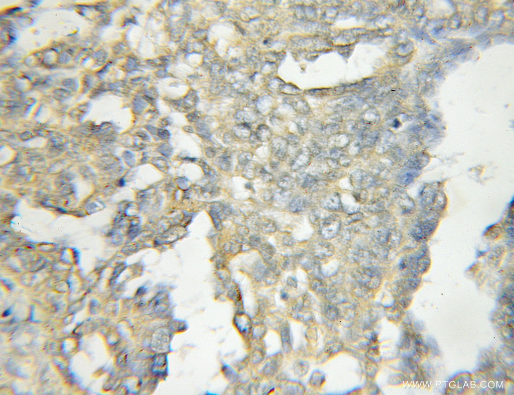 OSBPL11 Polyclonal antibody
