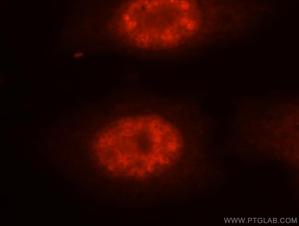 NASP Polyclonal antibody