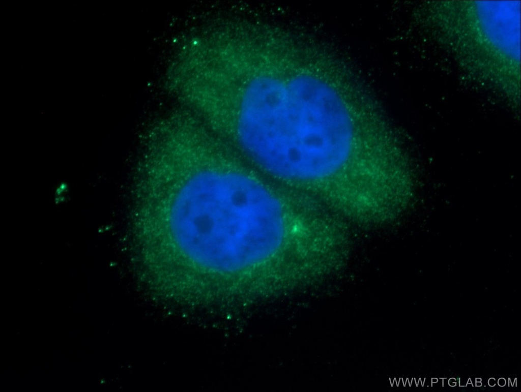 RAB35 Polyclonal antibody
