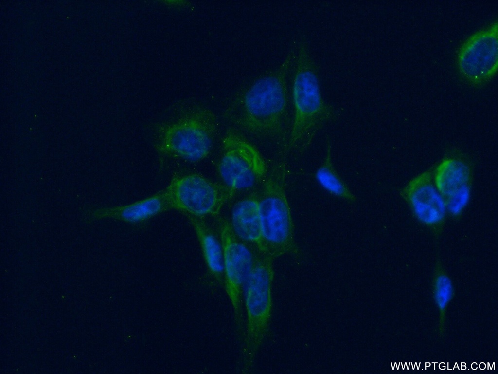EIF2B4 Polyclonal antibody