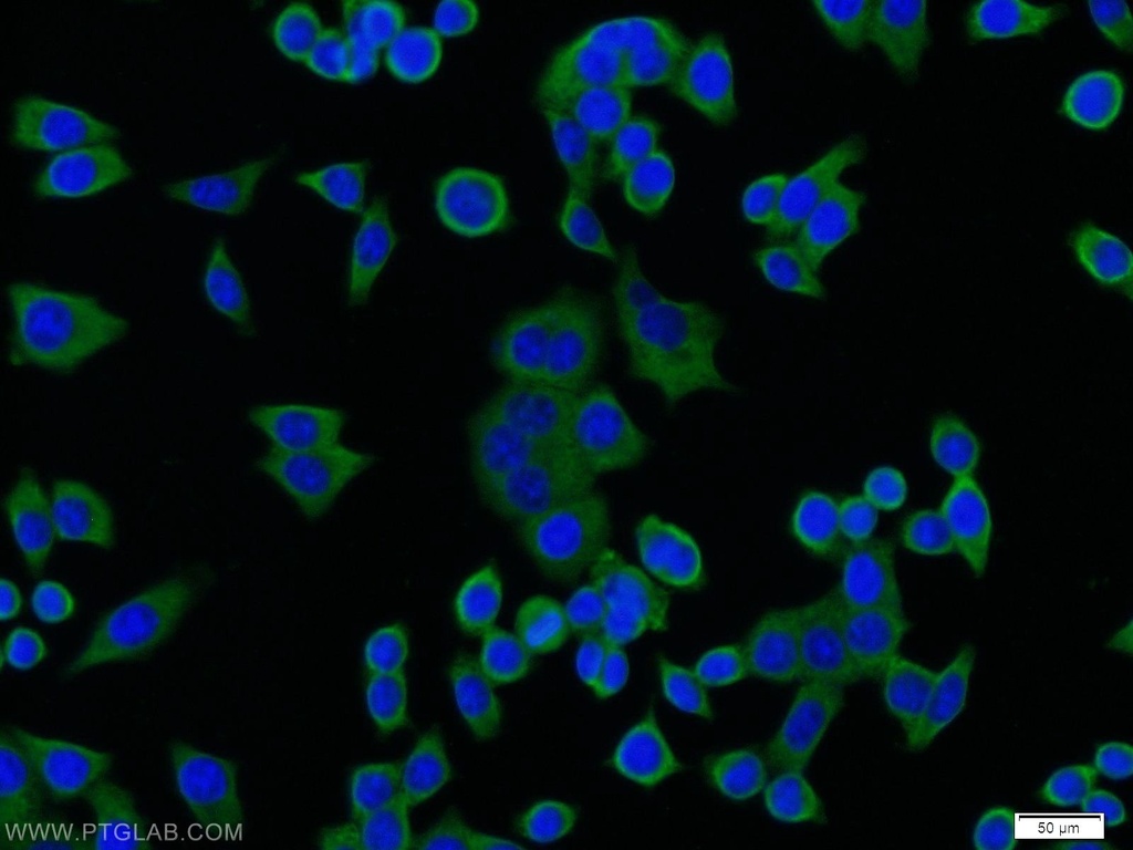 PTP1B Polyclonal antibody