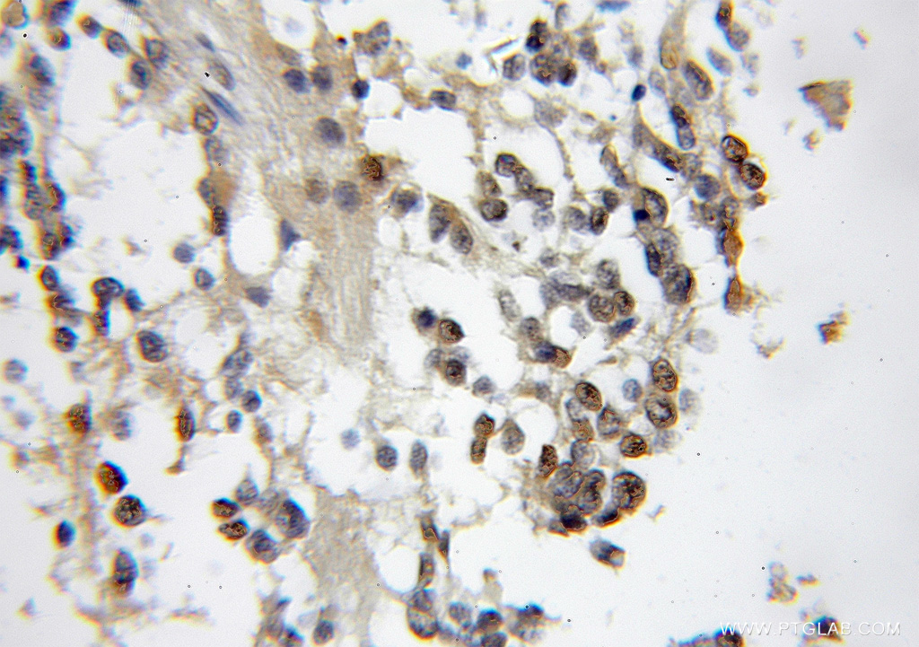 CBFA2T2 Polyclonal antibody