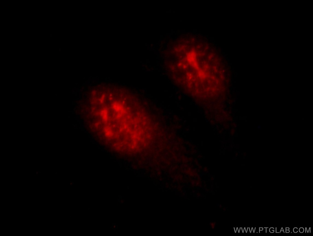 HOP2 Polyclonal antibody