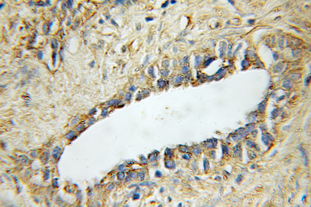 STAMBP Polyclonal antibody