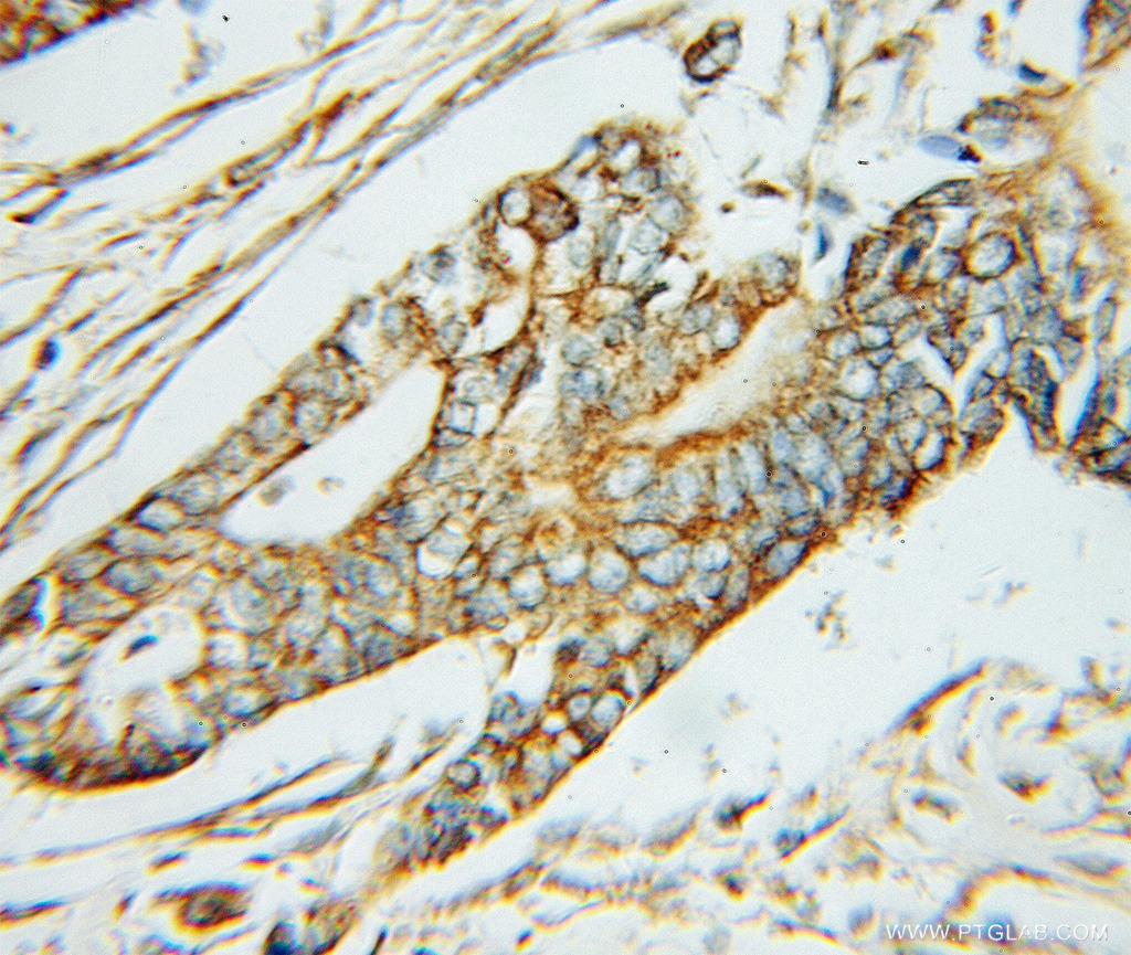 ABAT Polyclonal antibody