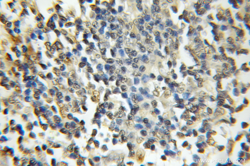 DDX1 Polyclonal antibody