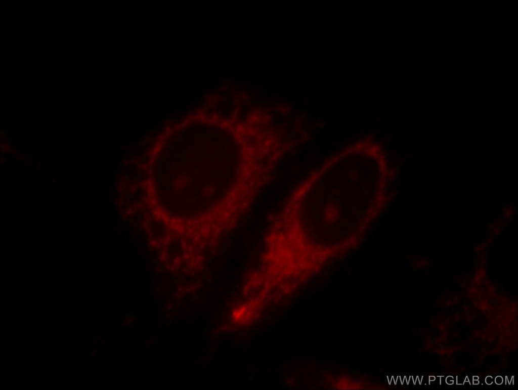 Harmonin Polyclonal antibody