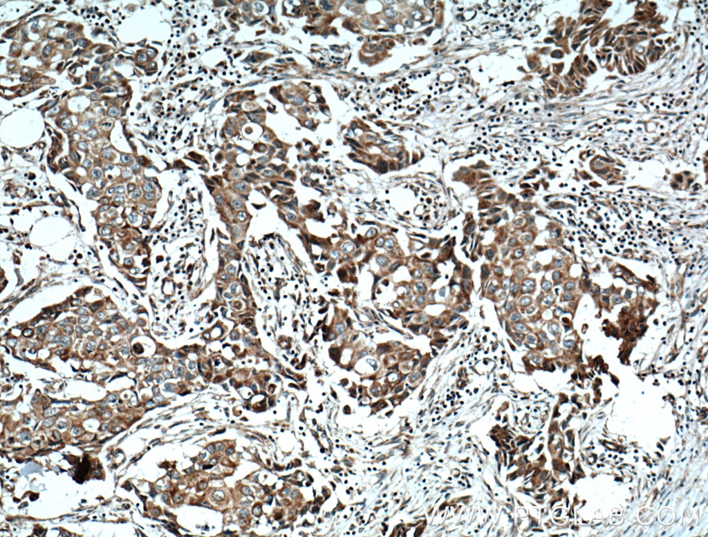 NCKIPSD Polyclonal antibody