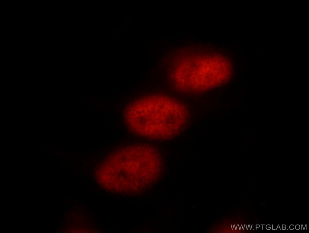 TLE3 Polyclonal antibody