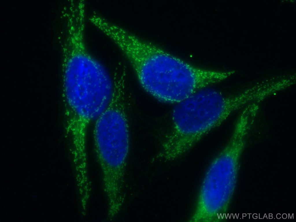 FH Polyclonal antibody