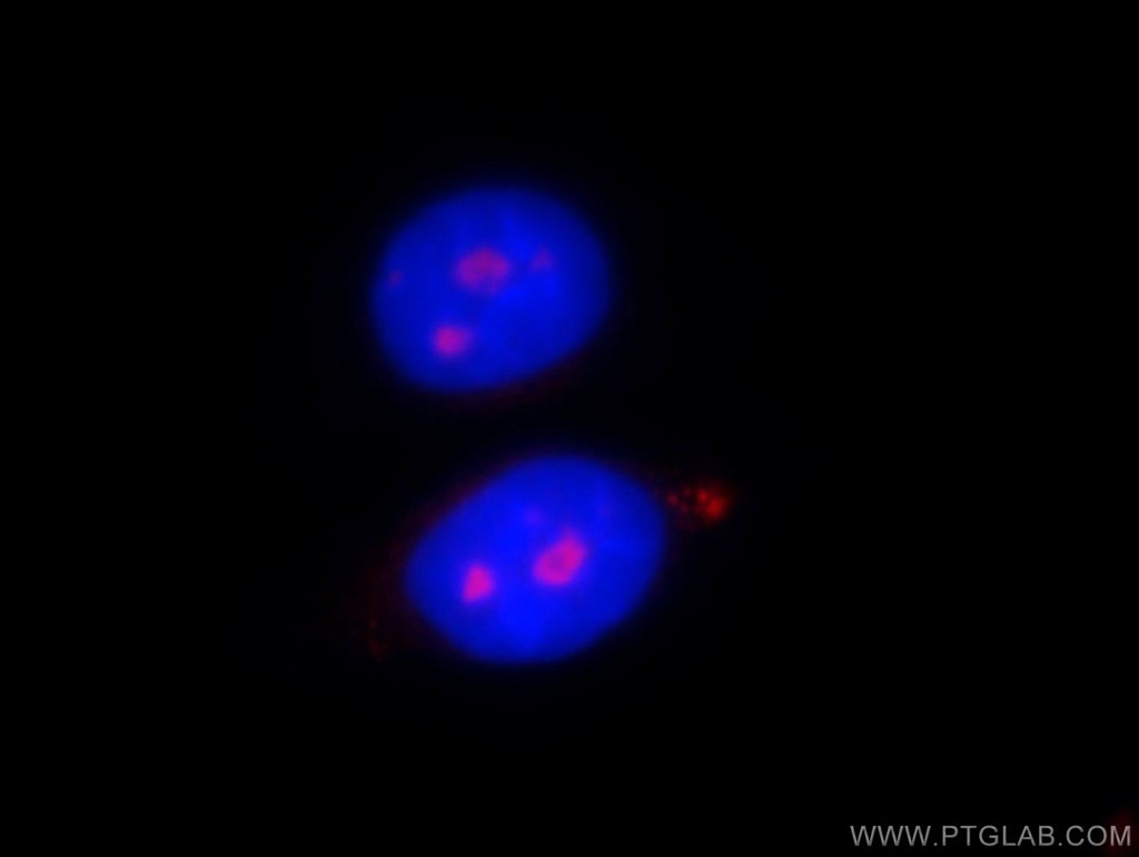 PWP2 Polyclonal antibody