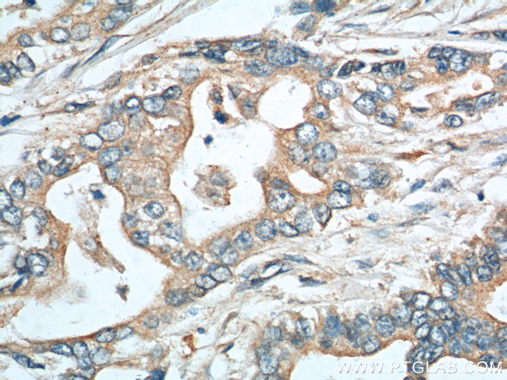 EPCR Polyclonal antibody