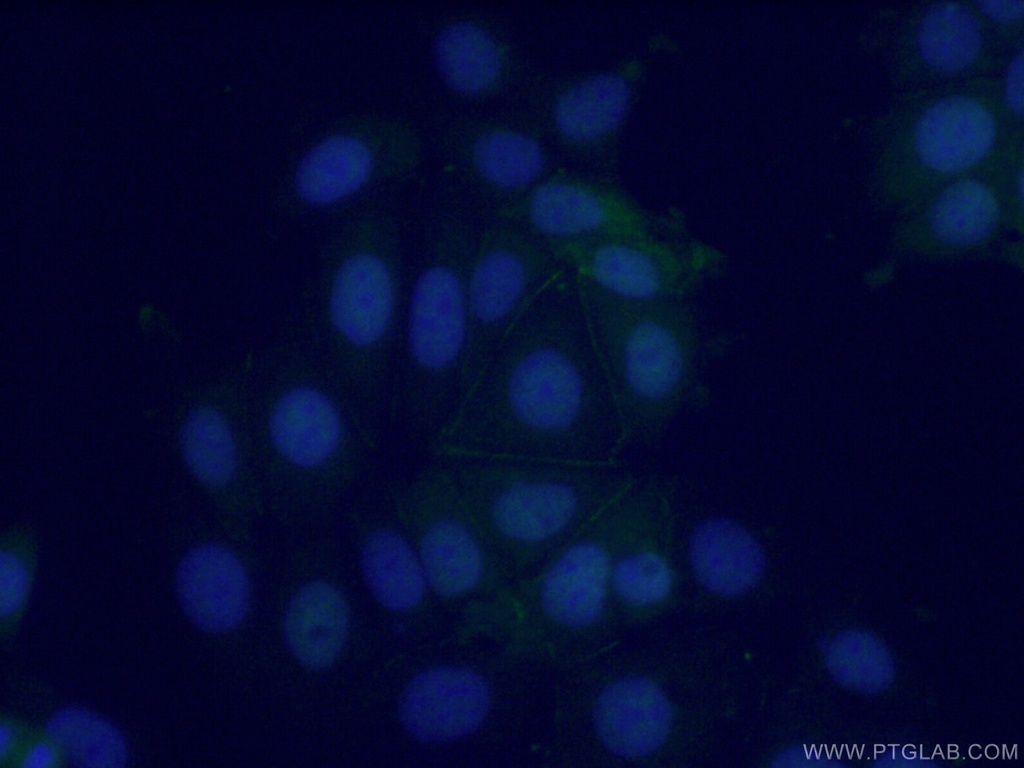 POF1B Polyclonal antibody