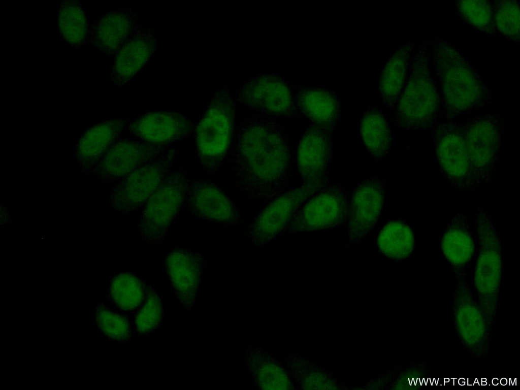 ASRGL1 Polyclonal antibody