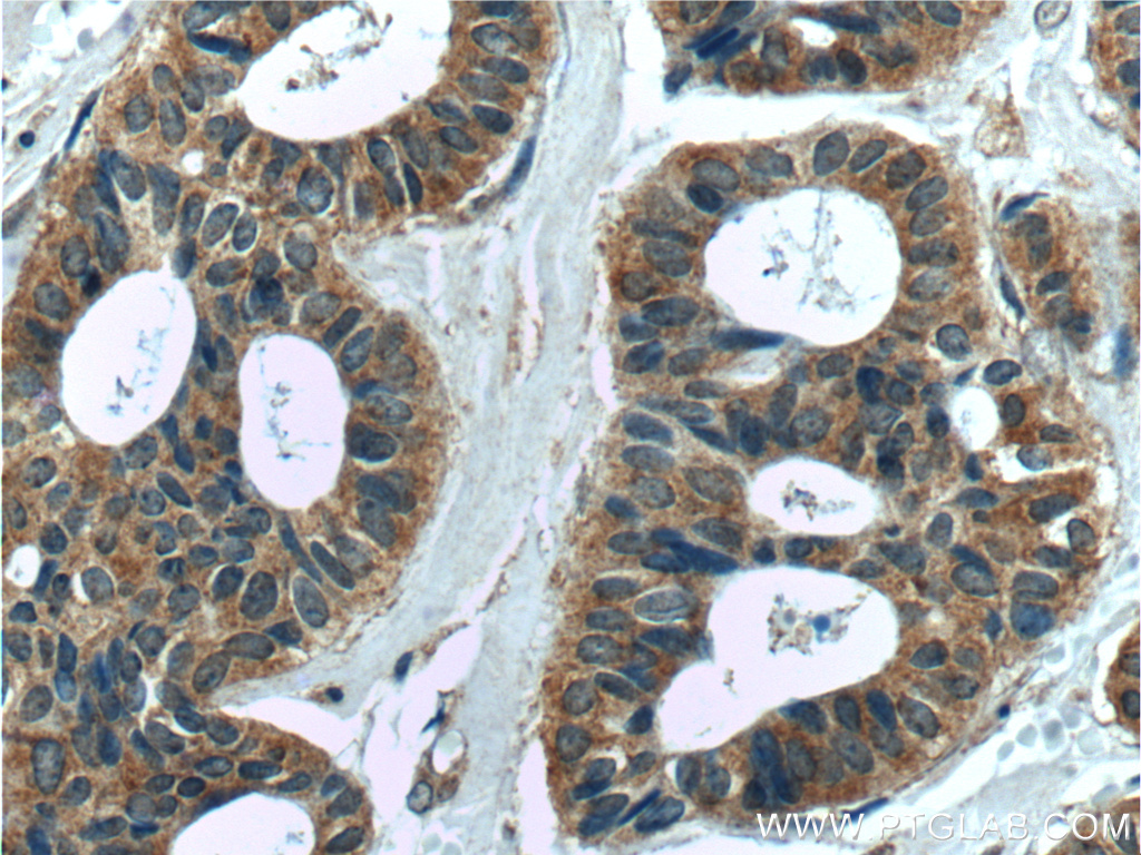 MELK Polyclonal antibody