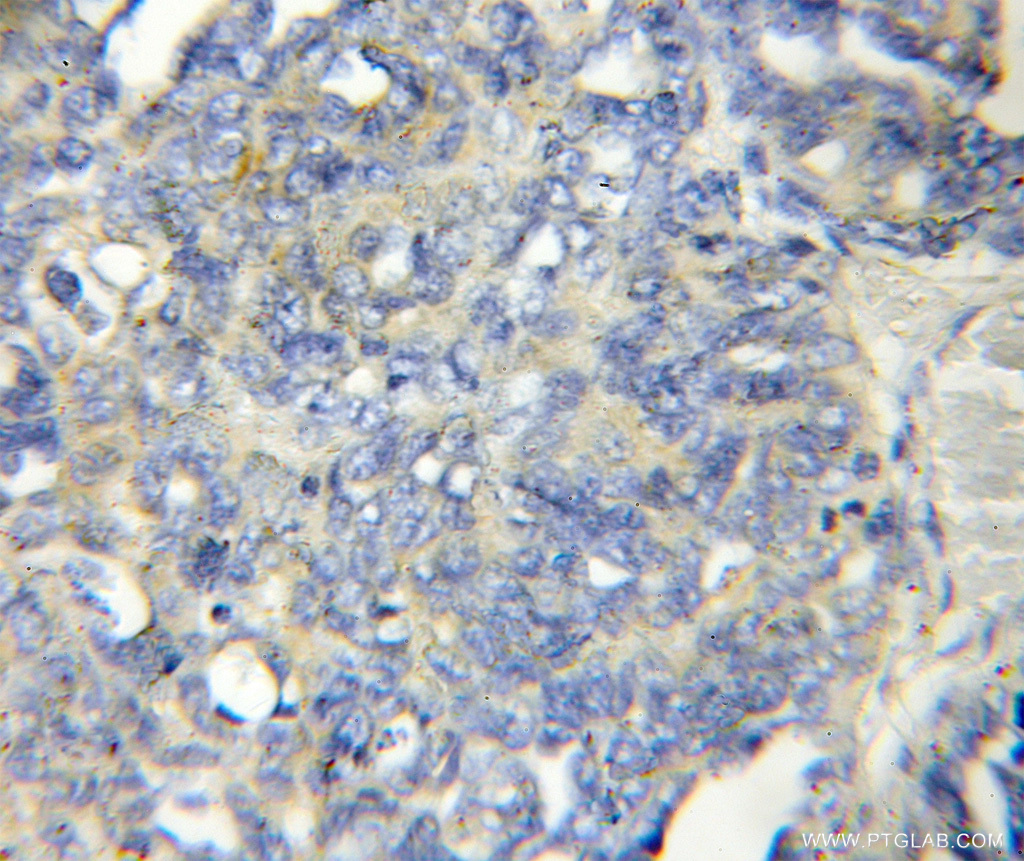 LENG1 Polyclonal antibody