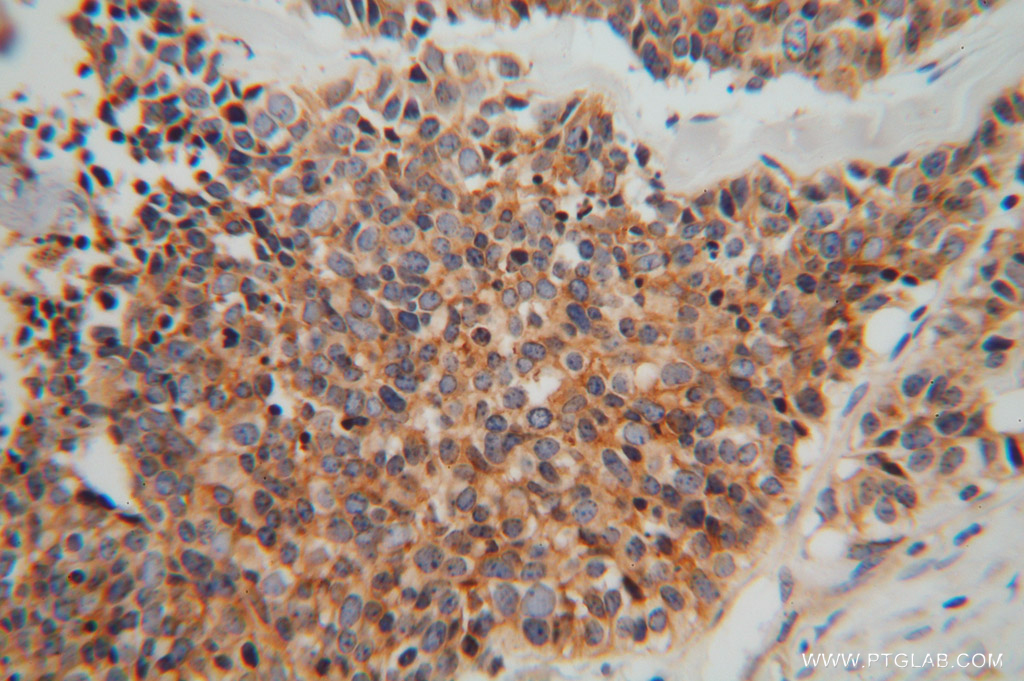 MARCKSL1 Polyclonal antibody