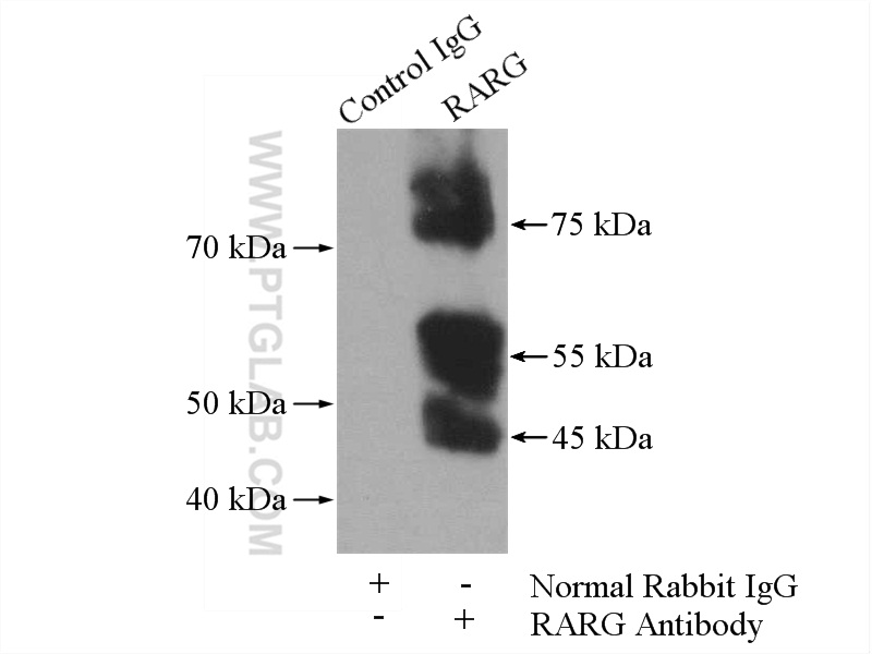 RARG Polyclonal antibody