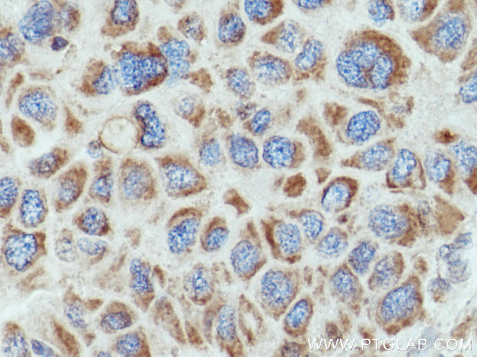 COX6B1 Polyclonal antibody