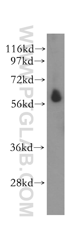 STK32C Polyclonal antibody