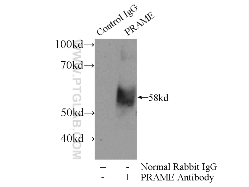 PRAME Polyclonal antibody