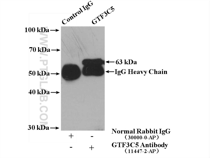 GTF3C5 Polyclonal antibody