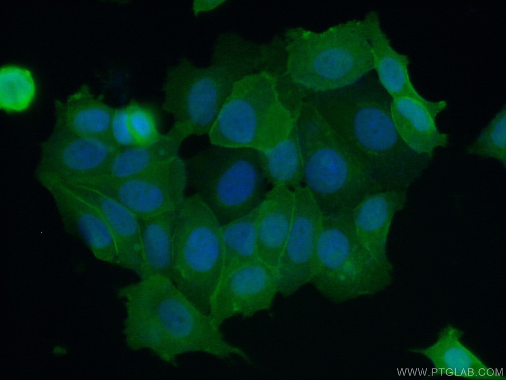 S100A16 Polyclonal antibody