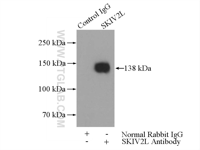 SKIV2L Polyclonal antibody