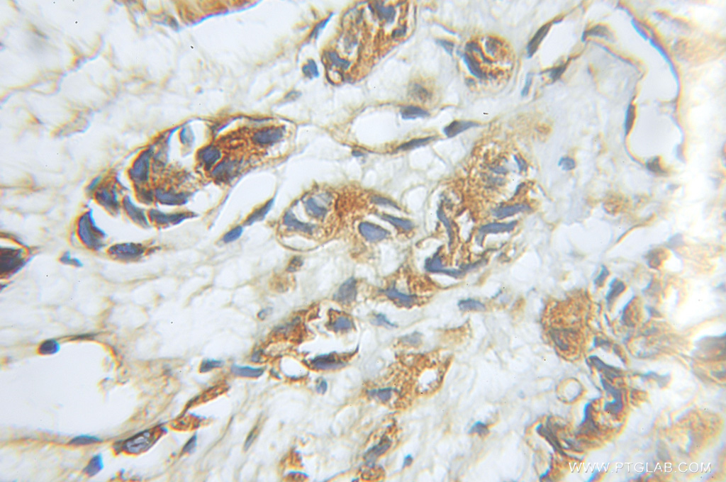 PSMD5 Polyclonal antibody