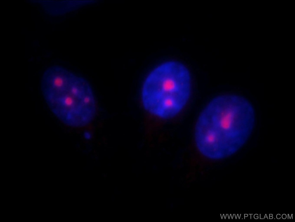 UTP14A Polyclonal antibody