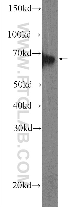 EIF3L Polyclonal antibody