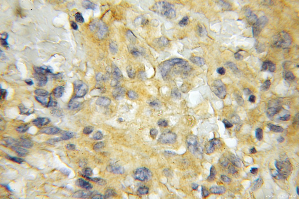SCRN2 Polyclonal antibody