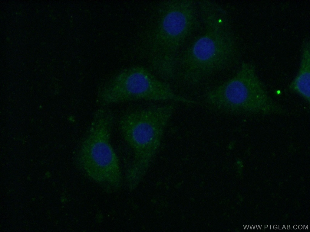 CAPS1 Polyclonal antibody