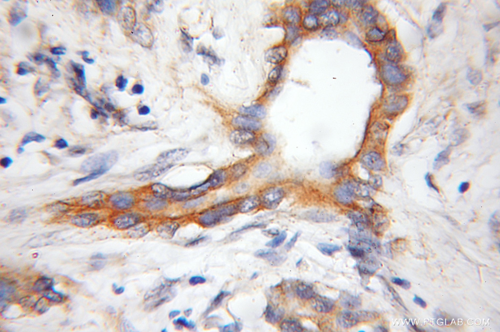 COX11 Polyclonal antibody