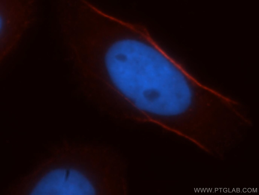 CNN3 Polyclonal antibody