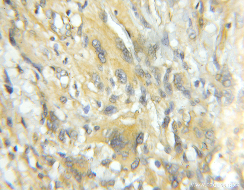 TRIM44 Polyclonal antibody