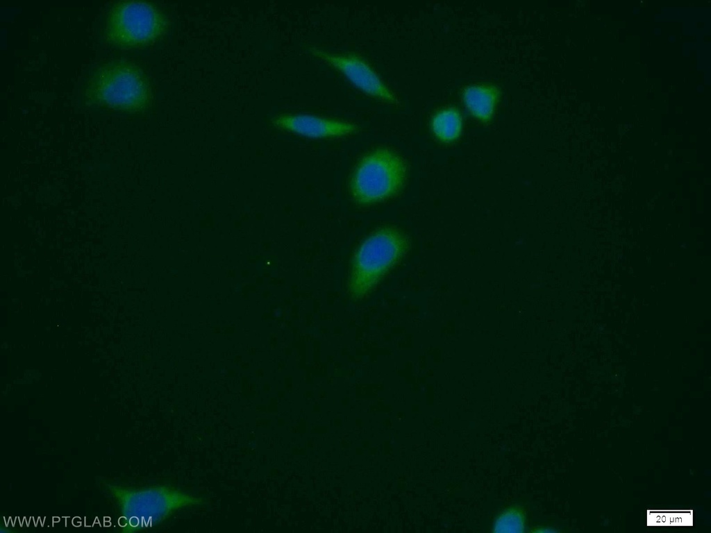 PUS1 Polyclonal antibody