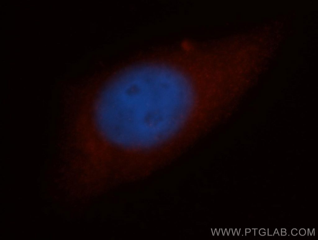 NCAPH Polyclonal antibody