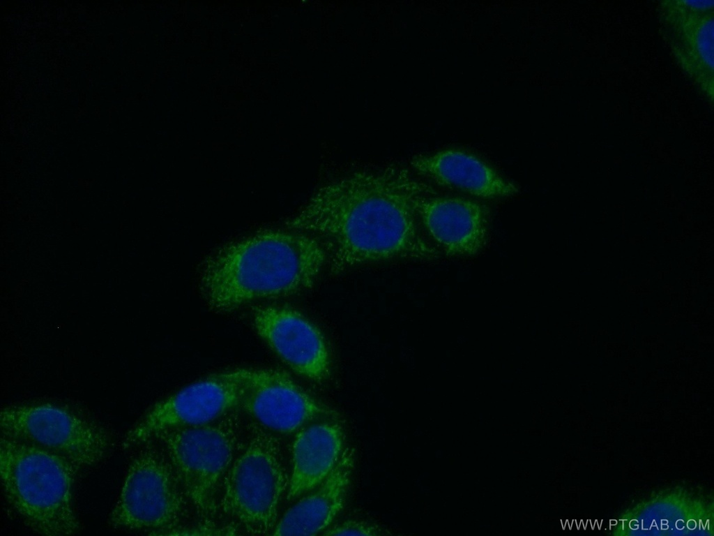 ECM1 Polyclonal antibody