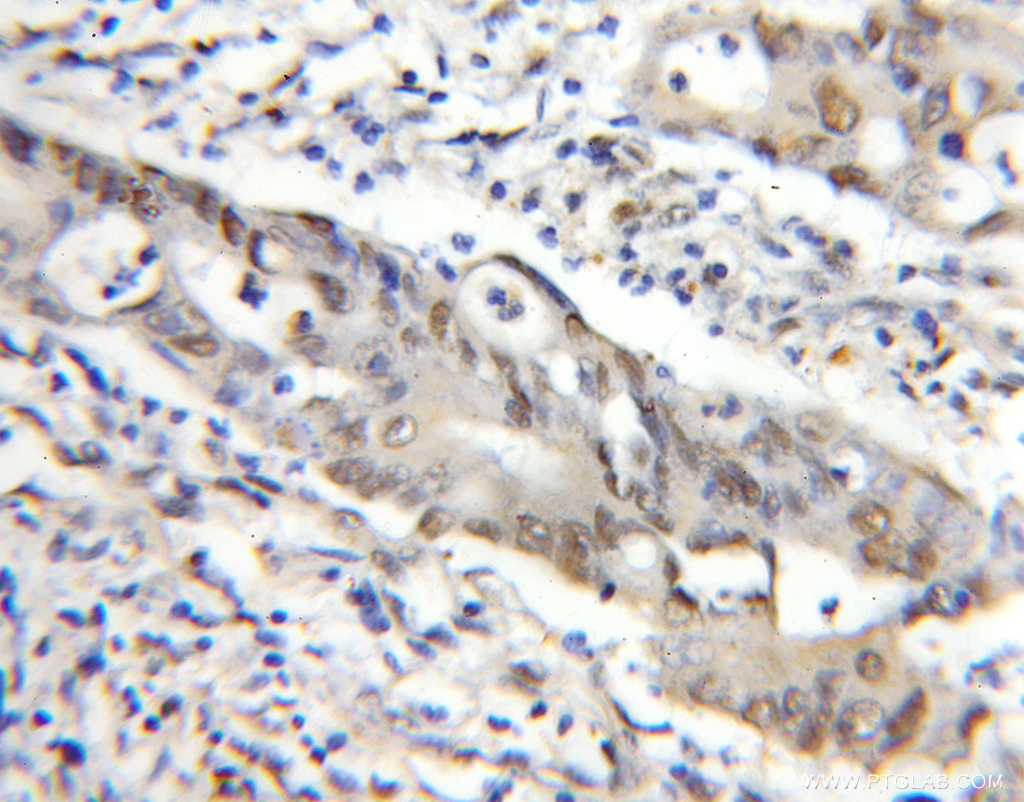 MEPCE Polyclonal antibody