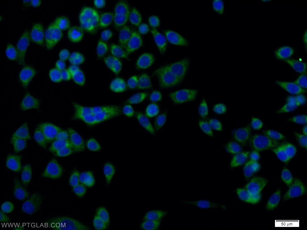 DCI Polyclonal antibody