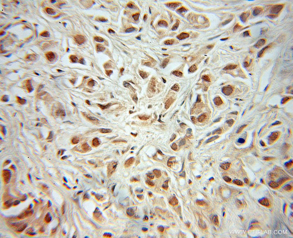 MEIS2 Polyclonal antibody