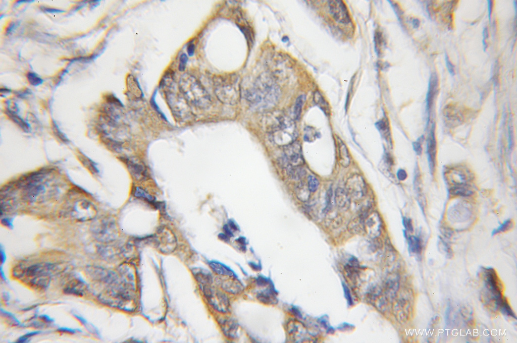 CHRNB1 Polyclonal antibody